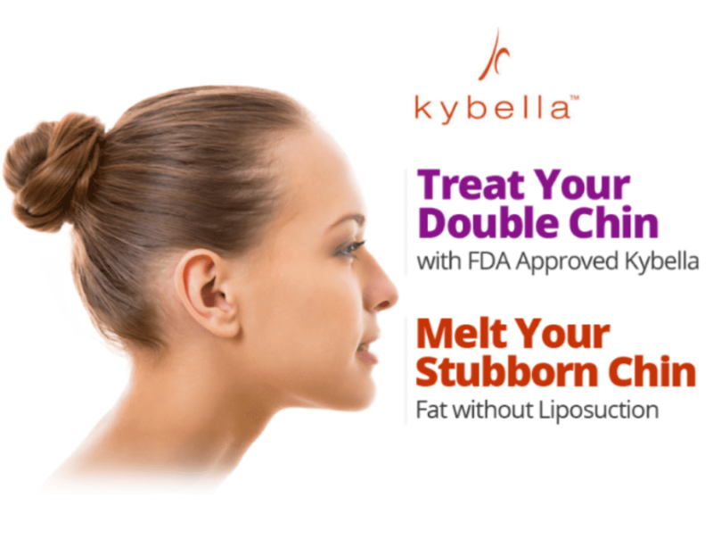kybella treatment infographic